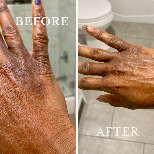 Eczema Butter - Violet Botanical Skincare®