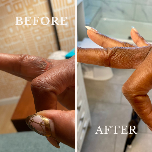 Eczema Butter - Violet Botanical Skincare®